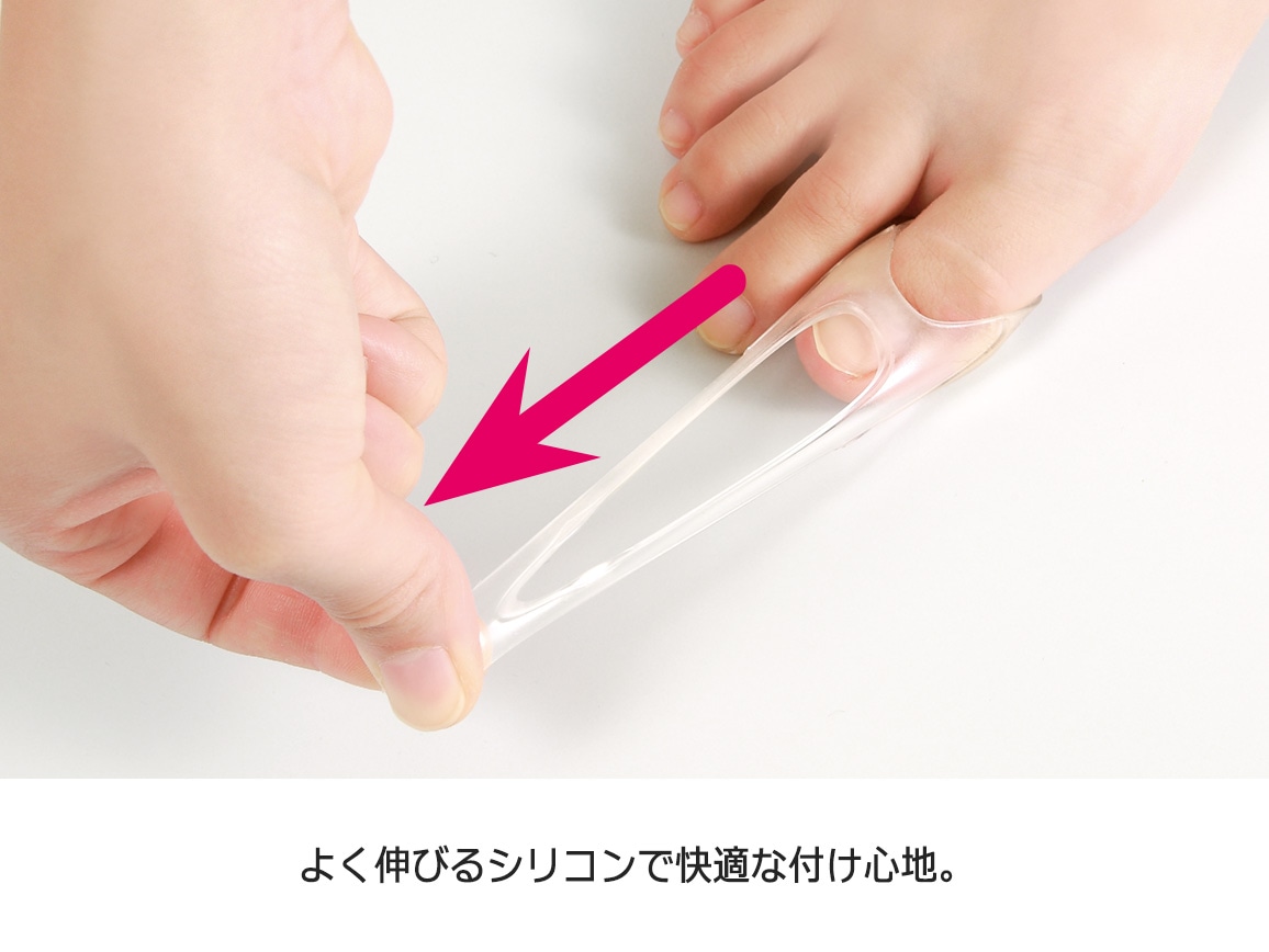 巻き爪ゲルエイド(2個入り) 巻き爪ゲルエイド(2個入り)