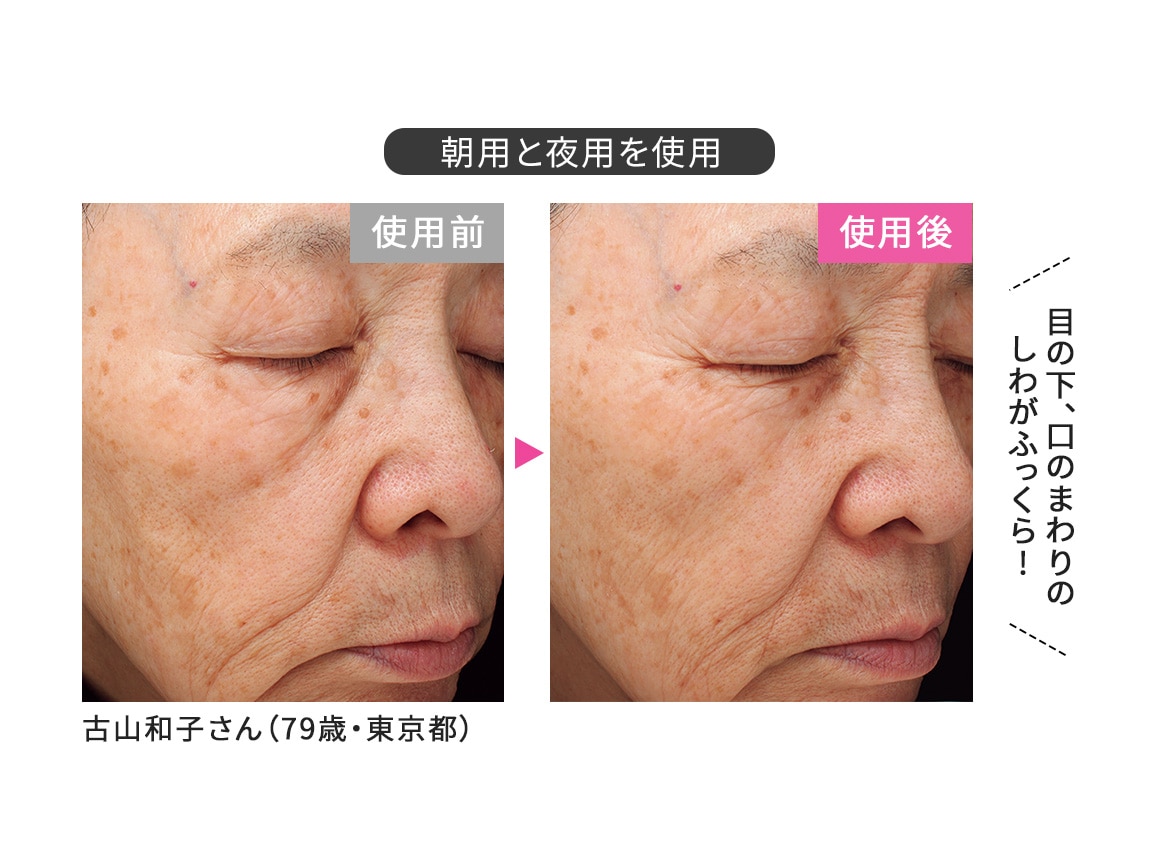 定期おトク便」ハルメク 薬用トータルエイジ美肌液＜夜用＞2本
