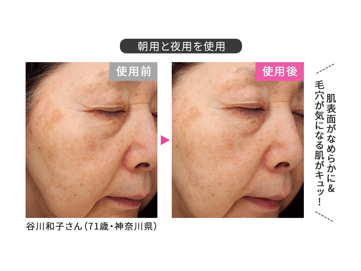 「定期おトク便」ハルメク 薬用トータルエイジ美肌液<夜用>2本組 90日コース 「定期おトク便」ハルメク 薬用トータルエイジ美肌液<夜用>2本組 90日コース