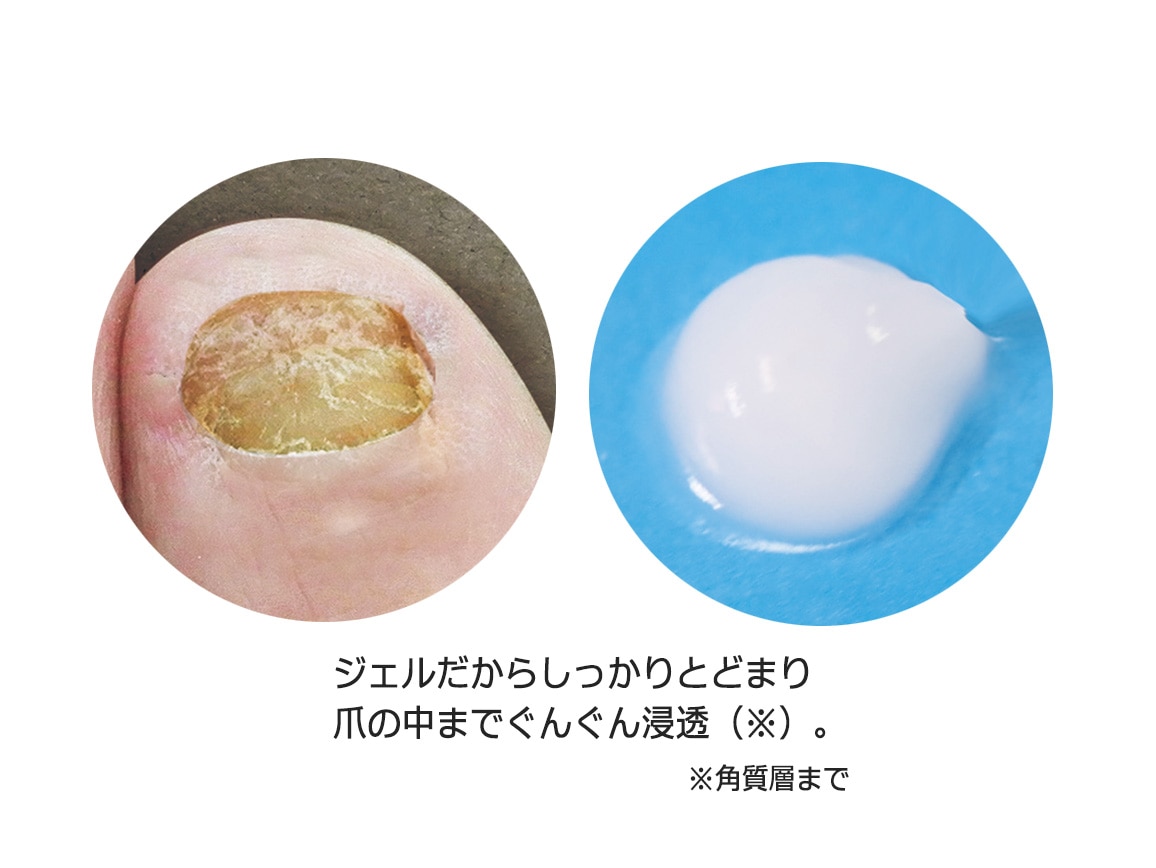 薬用 ツメキラリ(2本組) 薬用 ツメキラリ(2本組)