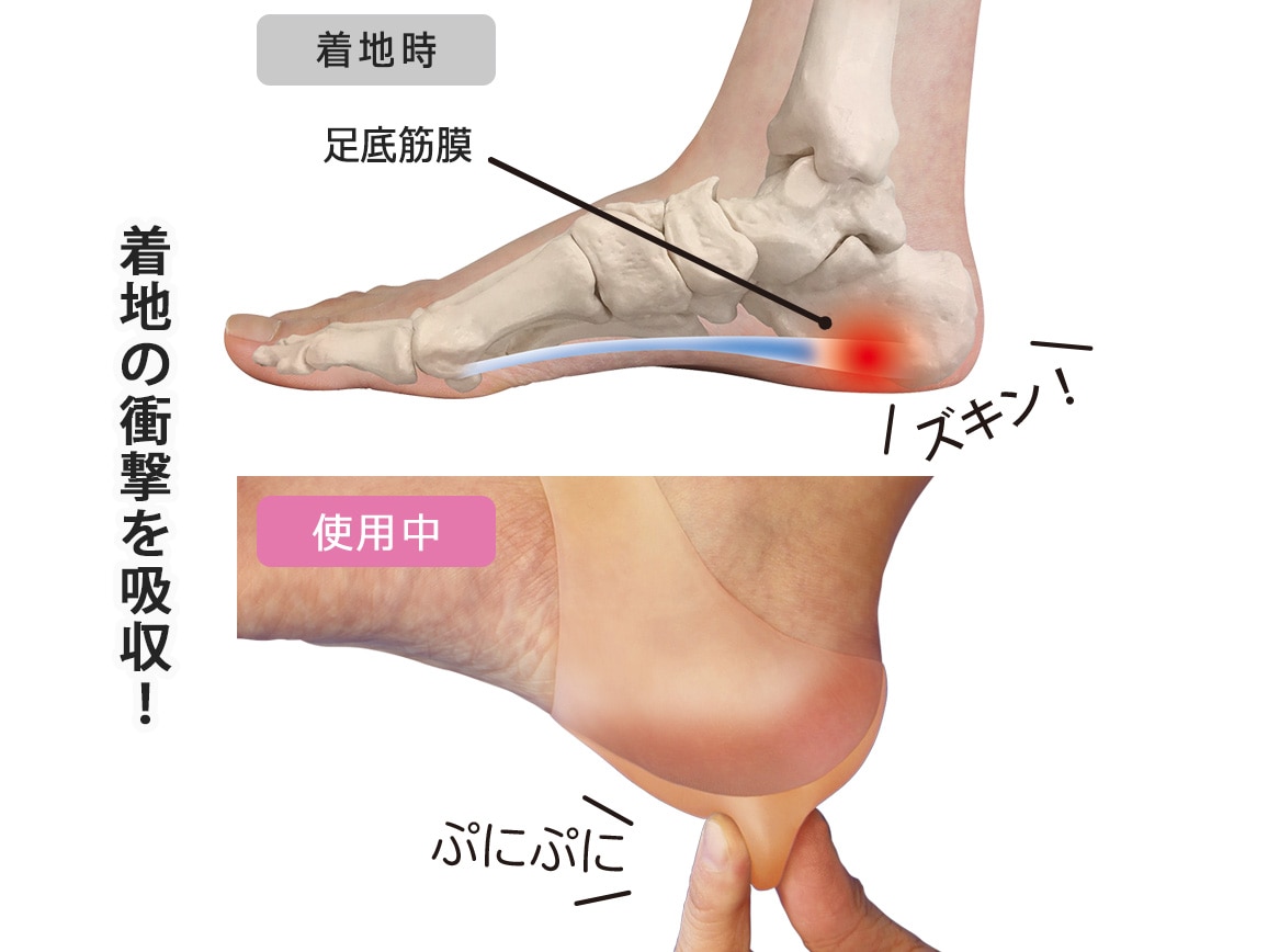 足底筋膜保護サポーター 1足組 (2個入) 足底筋膜保護サポーター 1足組 (2個入)