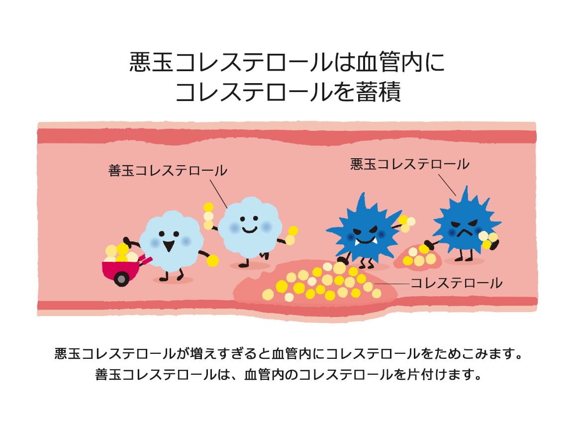 「定期おトク便」ハルメク 健康オイル<悪玉コレステロール>(2本)2か月ごとお届けコース 「定期おトク便」ハルメク 健康オイル<悪玉コレステロール>(2本)2か月ごとお届けコース