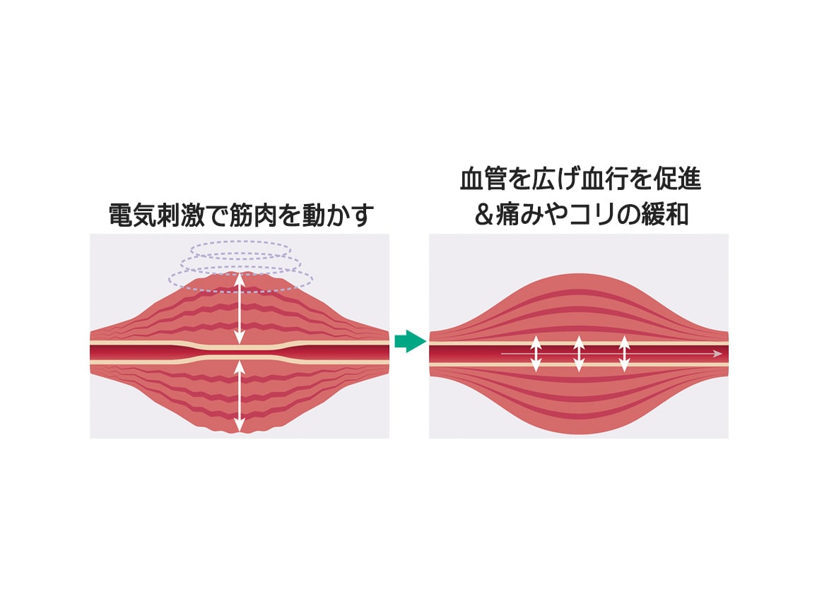 アテックスルルド 低周波治療器 コランゼ アテックスルルド 低周波治療器 コランゼ