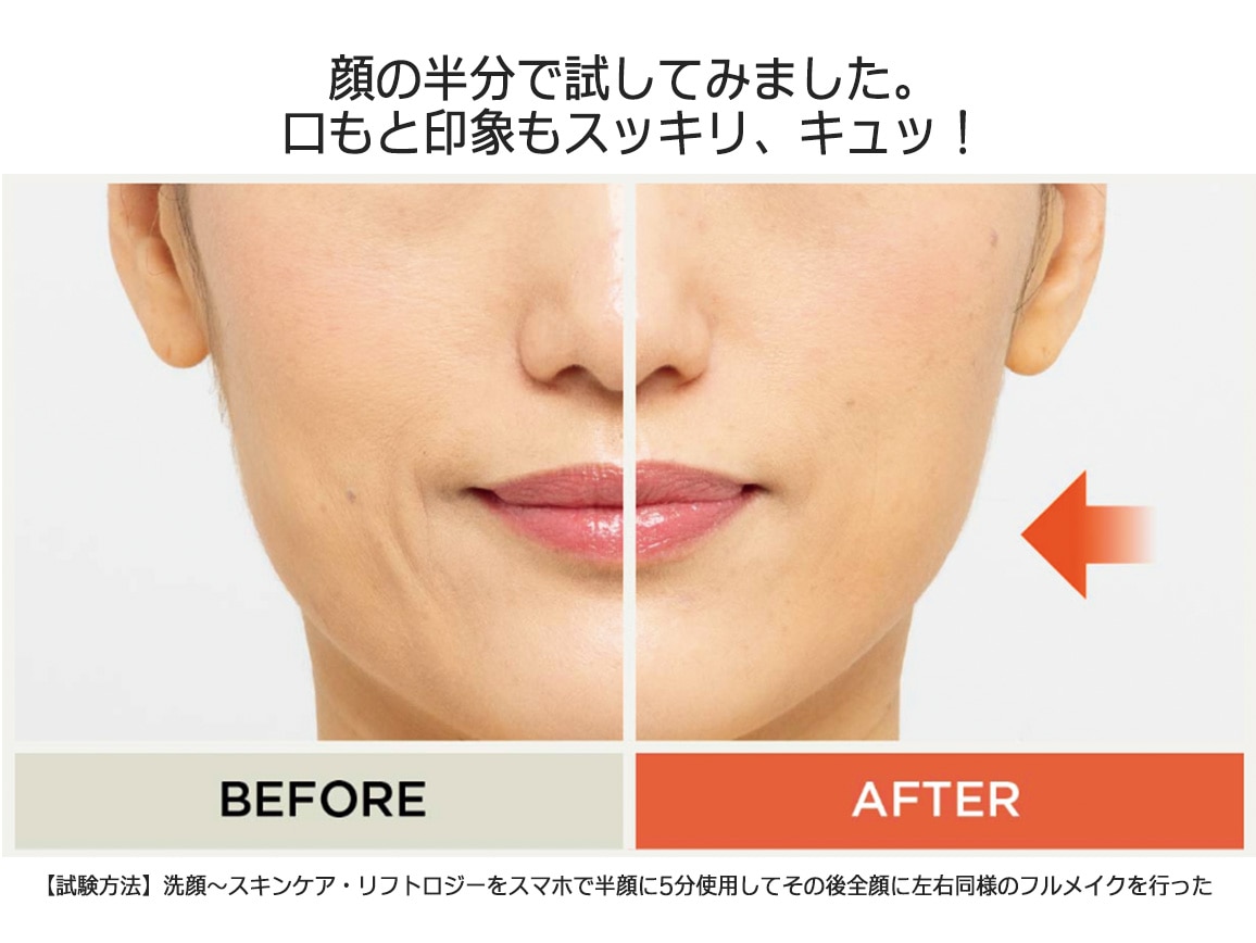 ヤーマン リフトロジー ヤーマン リフトロジー