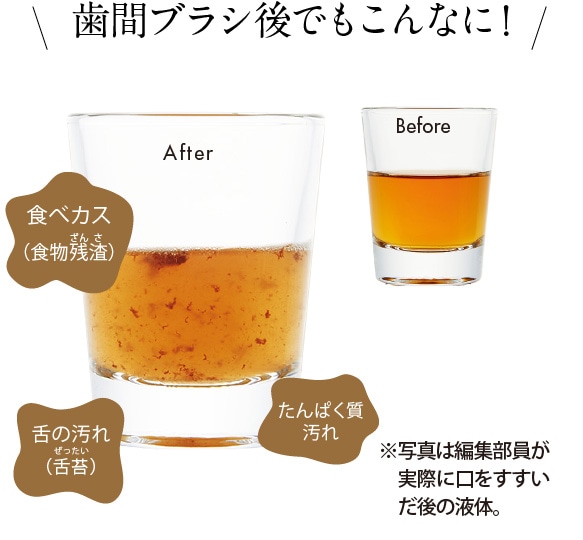 20秒くちゅくちゅするだけ!