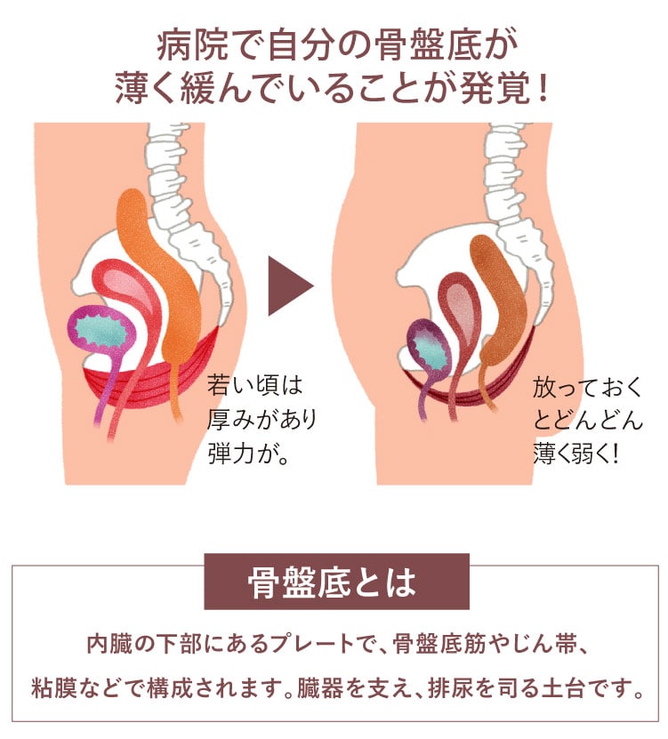 病院で自分の骨盤底が薄く緩んでいることが発覚!