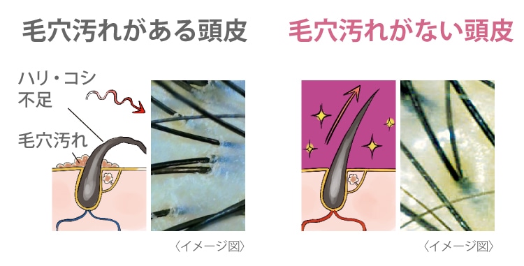 ぺたんこ原因をオフしてふわ。頭皮のニオイもスッキリ。