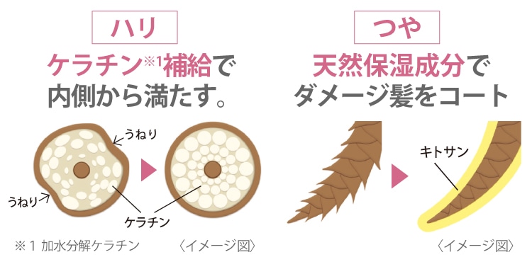 nN ̃net