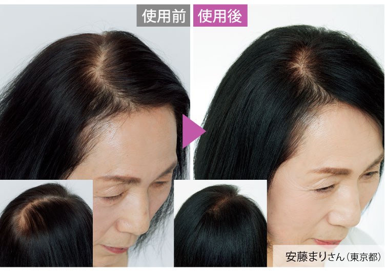 CɂȂĂn̓Az̍L̒ʂI