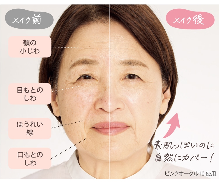 ���C�N�O��