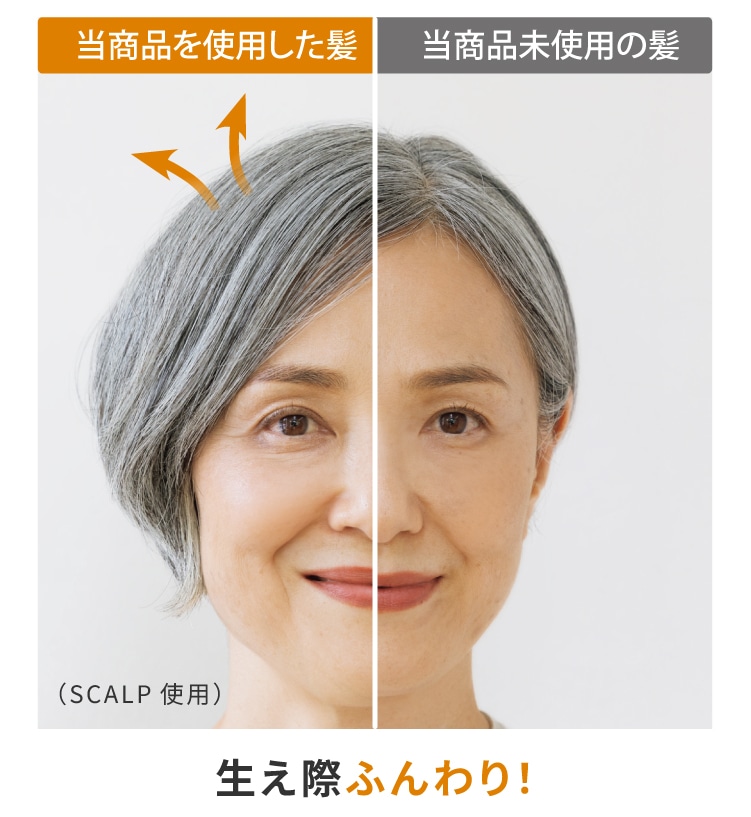 �M�_���[�W��}���A�v�����݂̂�ƃ{�����[���I���������A�y���A�������A�g������̂悳�����B