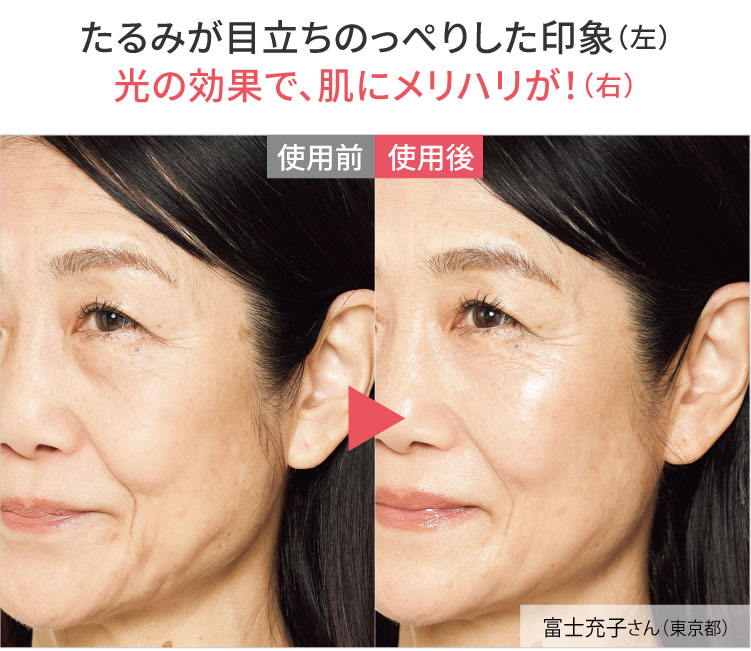 bbeforeafter