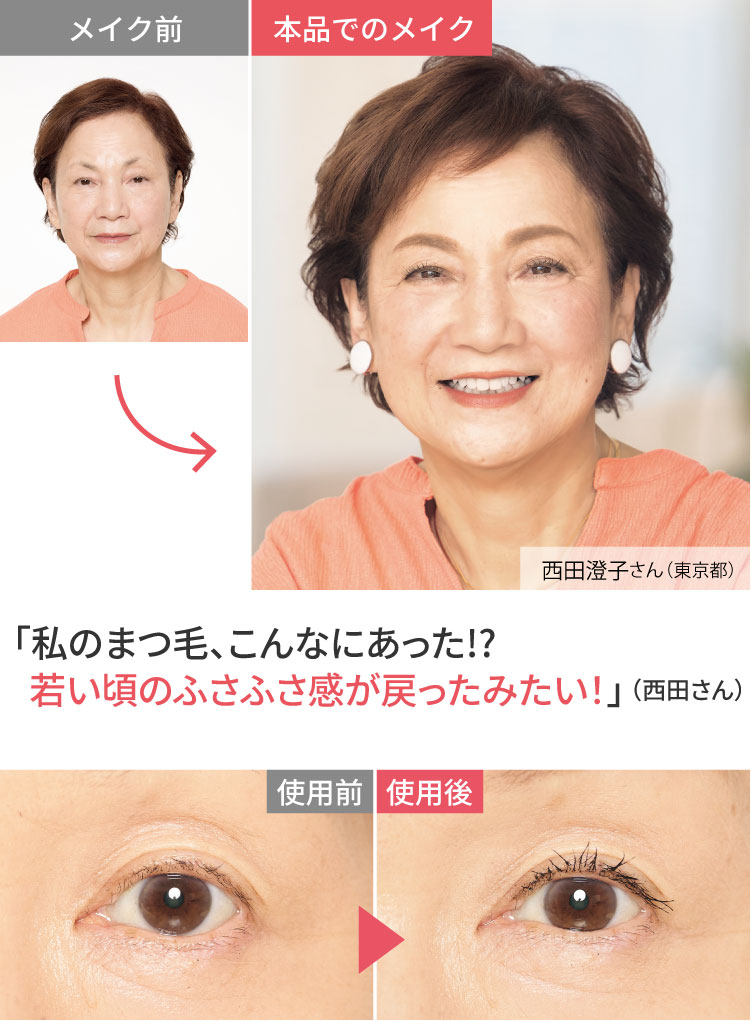 beforeafter