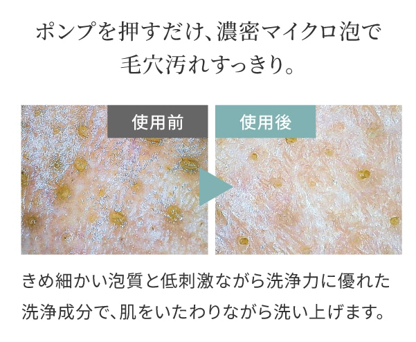 泡洗顔