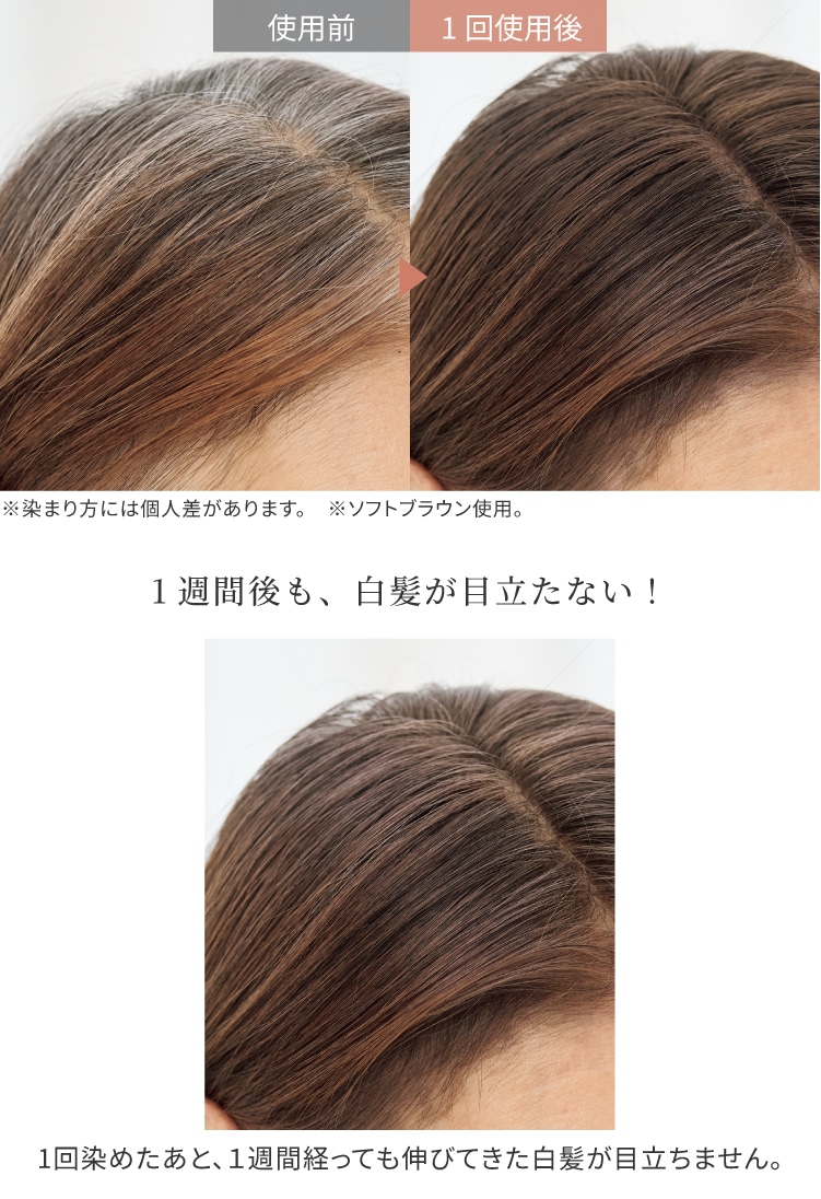 �w�A�}�j�L���A�g���[�g�����g
