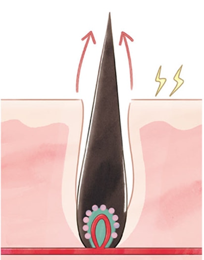 �����P�A�̓���