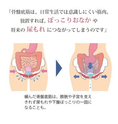 放置すれば、ぽっこりおなかや将来の尿もれにつながってしまうのです